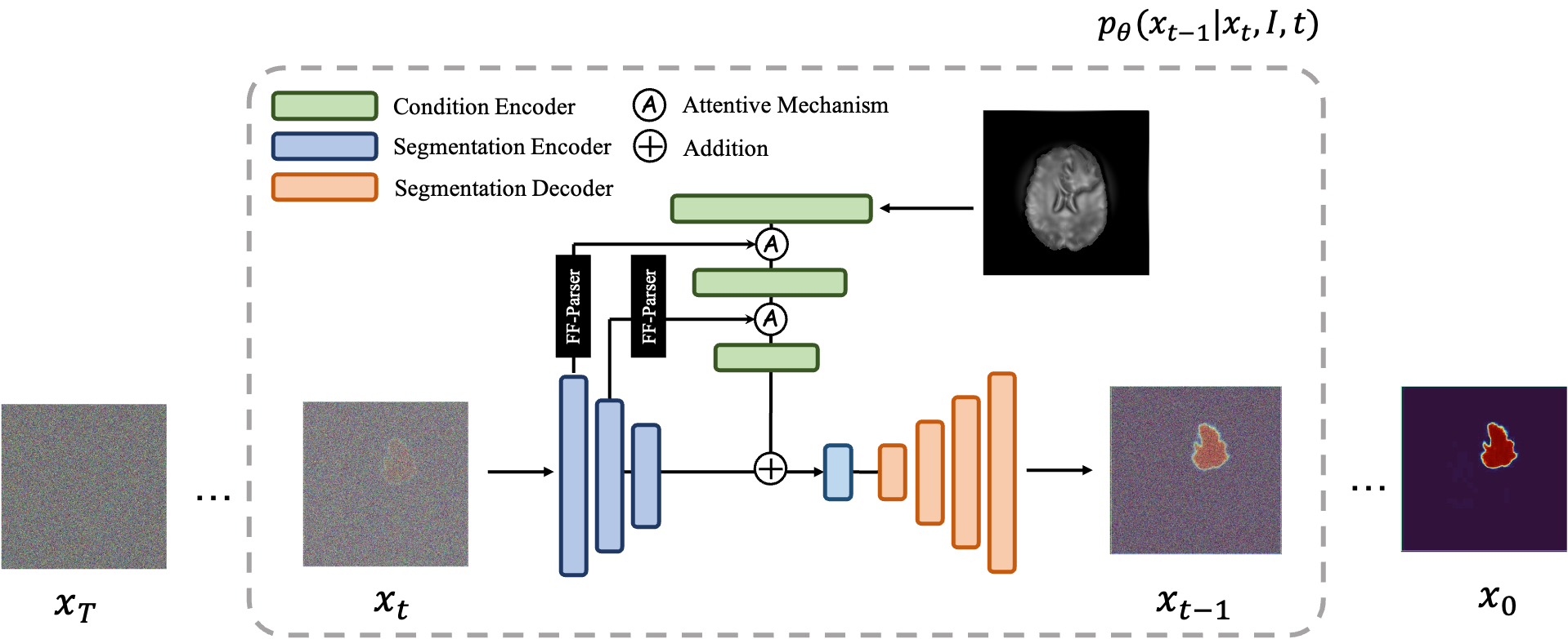 Image shows a diagram for the MedSegDiff diffusion model architecture