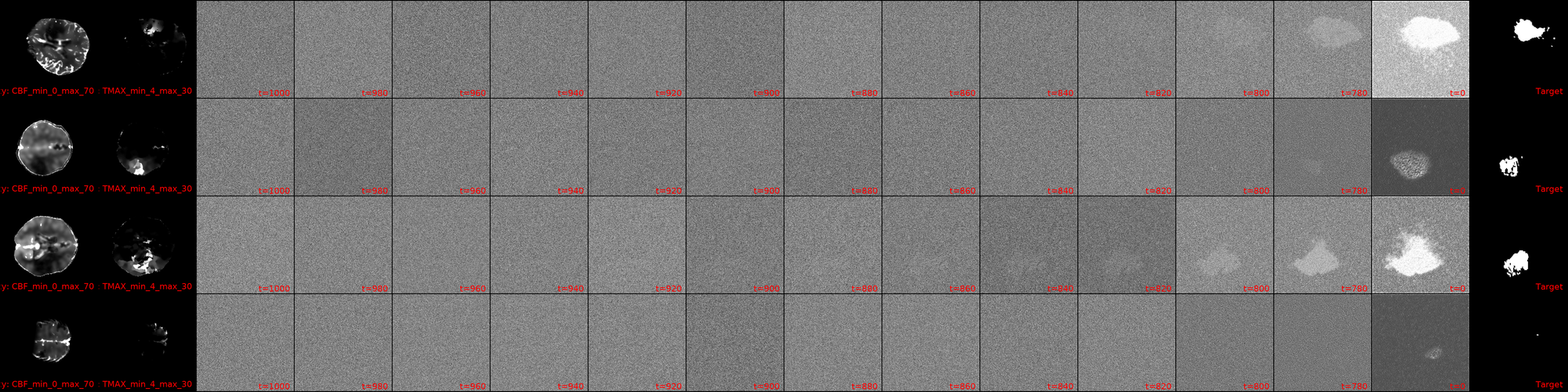 The image shows a grid showcasing the reverse diffusion process for samples from the ISLES24 dataset using the MedSegDiff model architecture.