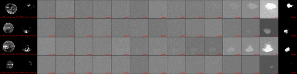 The image shows a grid showcasing the reverse diffusion process for samples from the ISLES24 dataset using the MedSegDiff model architecture.